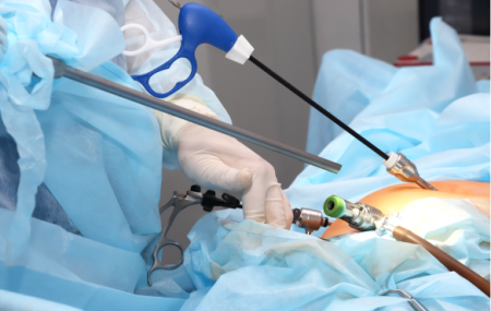 Лапароскопия: современный подход к хирургическому лечению Лапароскопия: современный подход к хирургическому лечению